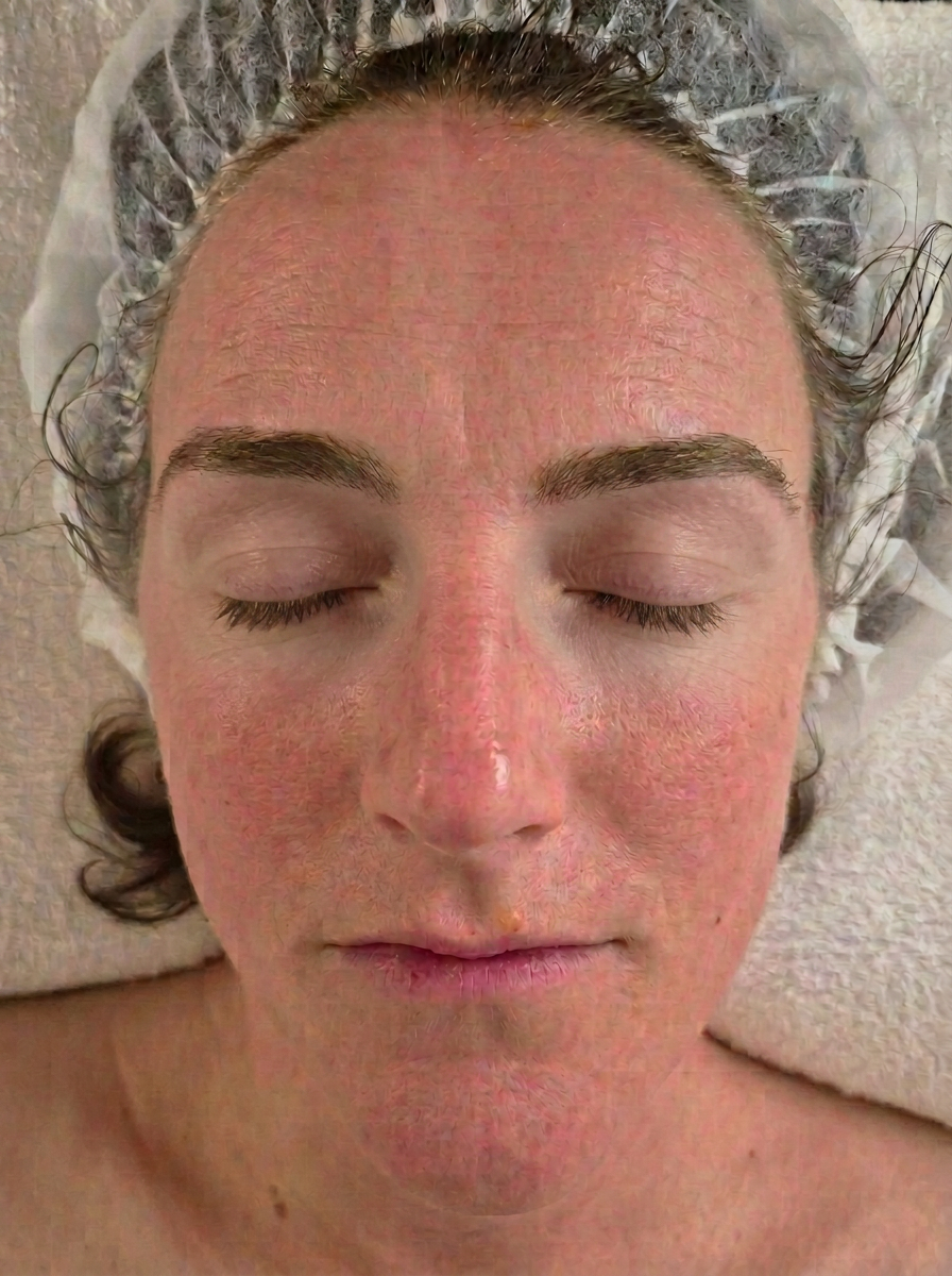 Visage après un massage facial Kobido — éclat et détente