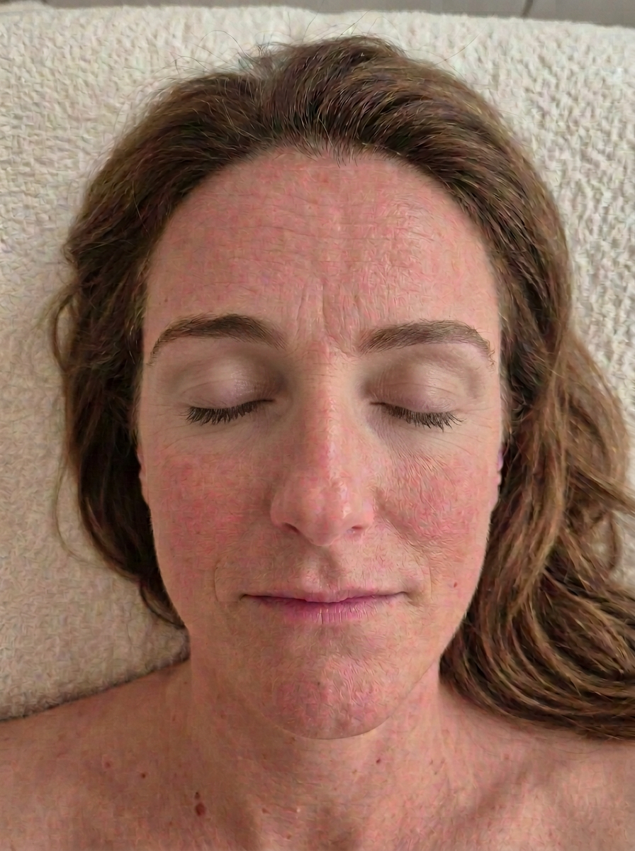 Visage avant un massage facial Kobido